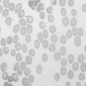 image cells LPE