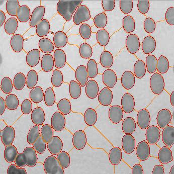 image cells LPE