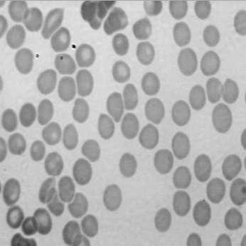 image cells LPE