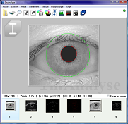 ImAnalyse user interface